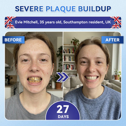Whiten your teeth in just 7 days 🦷 Glimmerly® Tideglusib Fast‑Dissolving Tooth & Gum Repair Oral Strips ⚡ (Supports tooth repair and helps relieve gum discomfort and other common oral concerns)