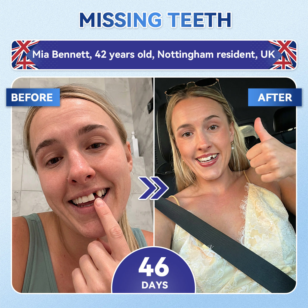 Whiten your teeth in just 7 days 🦷 Glimmerly® Tideglusib Fast‑Dissolving Tooth & Gum Repair Oral Strips ⚡ (Supports tooth repair and helps relieve gum discomfort and other common oral concerns)